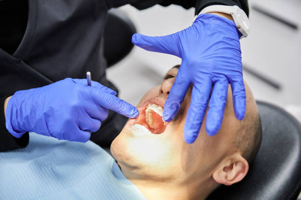 Best Emergency Dental Surgery in Saltillo, MS