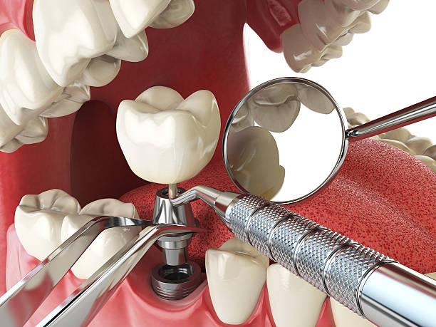Best Emergency Treatment for Toothache in Saltillo, MS
